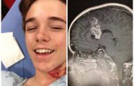 Joven estadounidense descubre que tenia un tumor en el cerebro gracias a un accidente.